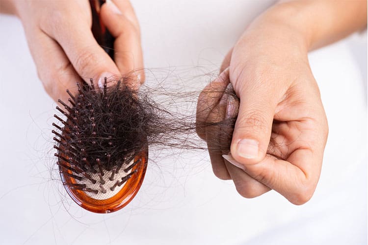 ریزش مو ناشی از اختلال در چخه رشد مو