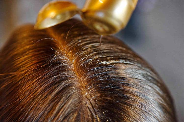 روغن تراپی مو برای جلوگیری از موخوره