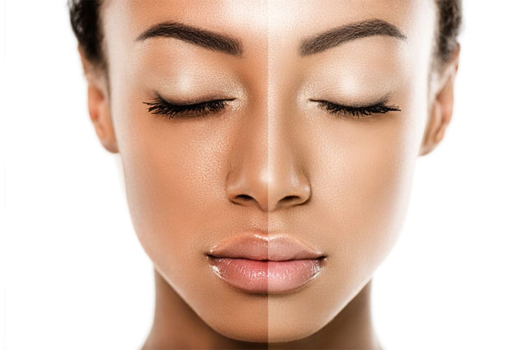 بهترین راهکارهای روشن شدن پوست و از بین بردن لک های پوستی