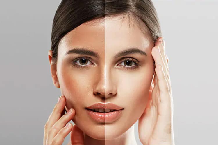 معرفی محصولات ضد لک و روشن کننده پوست صورت