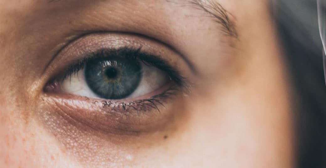 درمان سیاهی و پف دور چشم