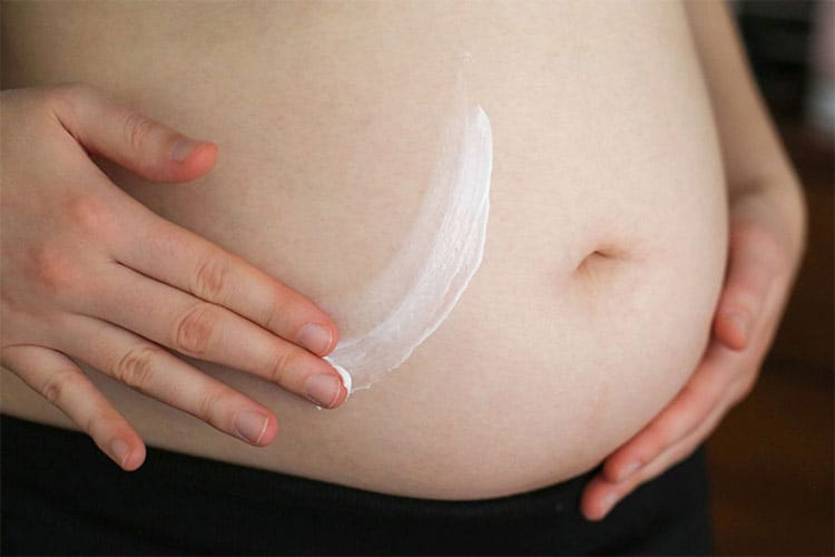 روش های جلوگیری از ترک شکم در دوران بارداری